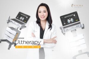 Ulthera Prime เครื่องยกกระชับผิว