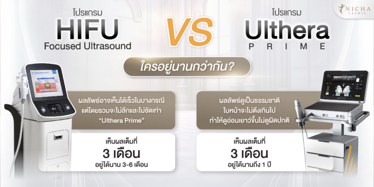 อินโฟกราฟิกเปรียบเทียบ HIFU และ Ulthera Prime ด้านผลลัพธ์การยกกระชับผิว ระยะเวลาเห็นผล และความยาวนานของผลลัพธ์หลังทำ